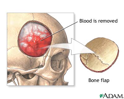 Procedure