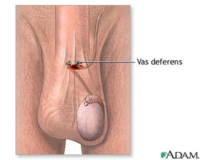 Procedure