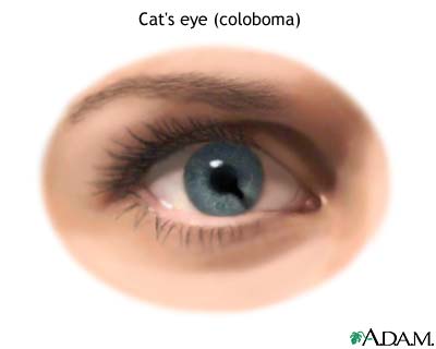 Cat eye