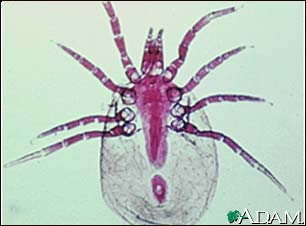 Dust mite