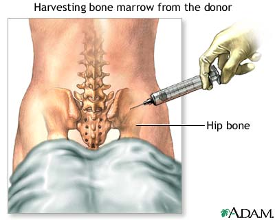 Procedure