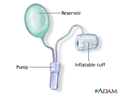 Procedure, part 1
