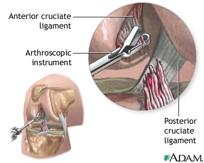 Procedure, part 2