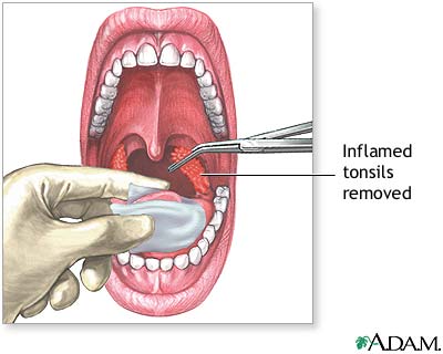 Procedure