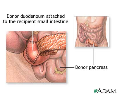 Procedure, part 1