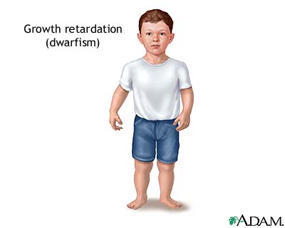 Indications