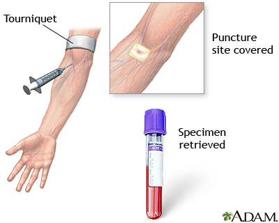 Procedure