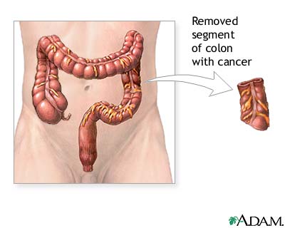 Procedure