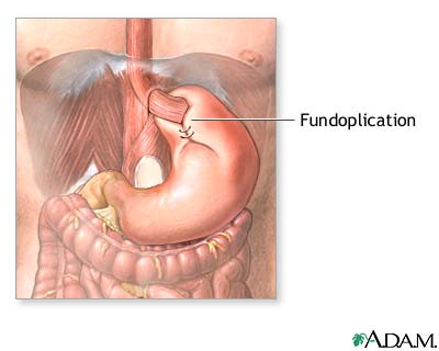 Procedure, part 2