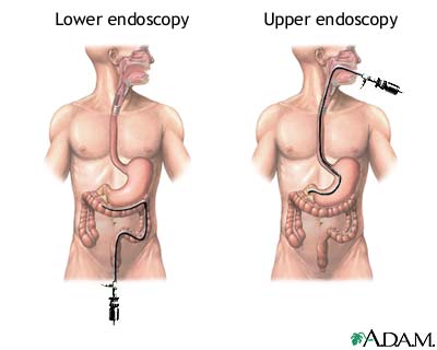 Procedure, part 1