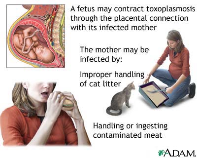 Congenital toxoplasmosis