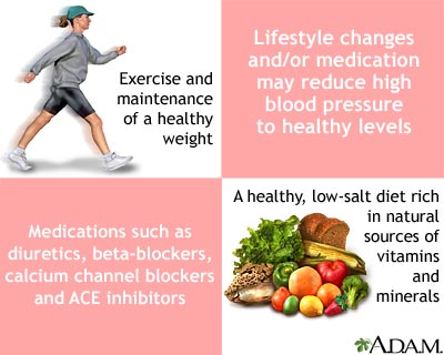 Lifestyle changes