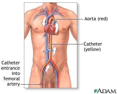 Procedure, part 1