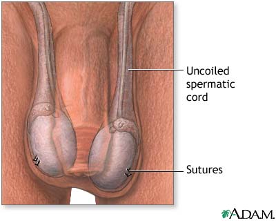 Procedure