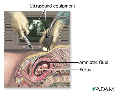 Procedure, part 1