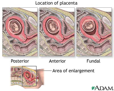 Procedure, part 1
