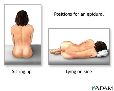 Procedure, part 2