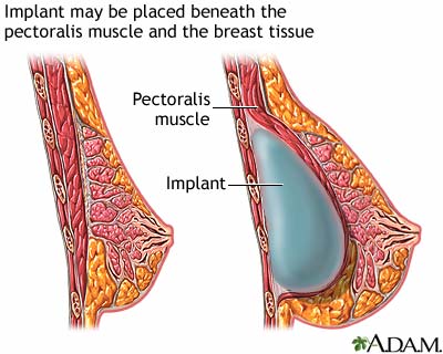 Procedure