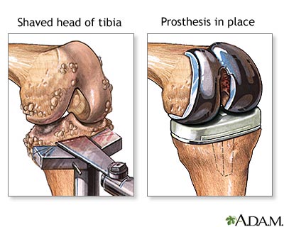 Procedure