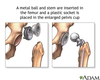 Procedure, part 2