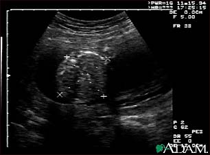 Ultrasound, normal fetus - abdomen measurements