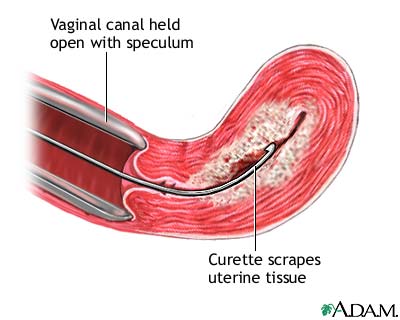 Procedure