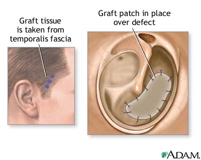 Procedure