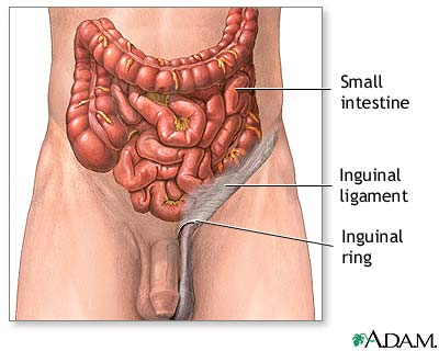Normal anatomy