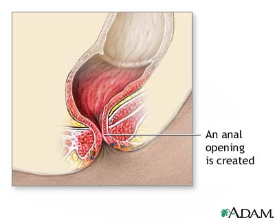 Procedure