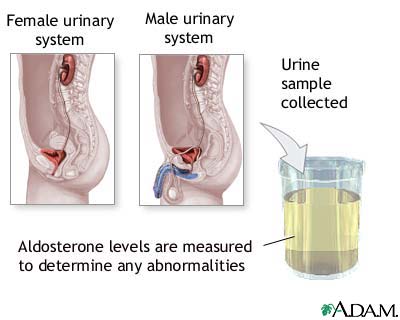 Aldosterone level test