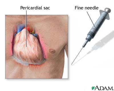 Pericardium