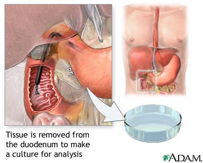 Duodenal tissue culture