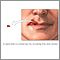 Viral lesion culture