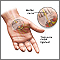 Compression of the median nerve