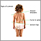 Signs of scoliosis