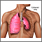 Collapsed lung, pneumothorax