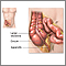 Appendectomy  - series