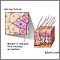 Aged hair follicle