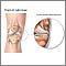 Medial collateral ligament