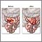 Before and after small intestine anastomosis