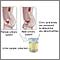 Citric acid urine test