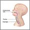 Endotracheal intubation