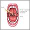 Throat swabs